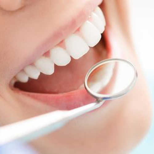 teeth-cleaning-treatment-at-nawale-dentocare-aurangabad