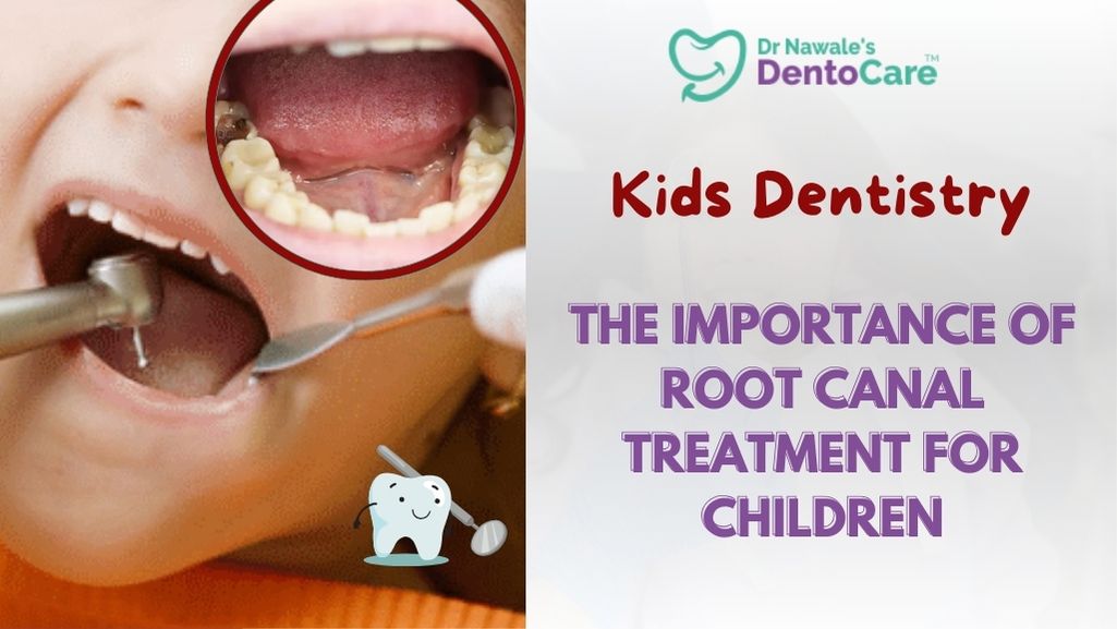 kids dentistry - The importance of root canal treatment for children in chh sambhajinagar aurangabad