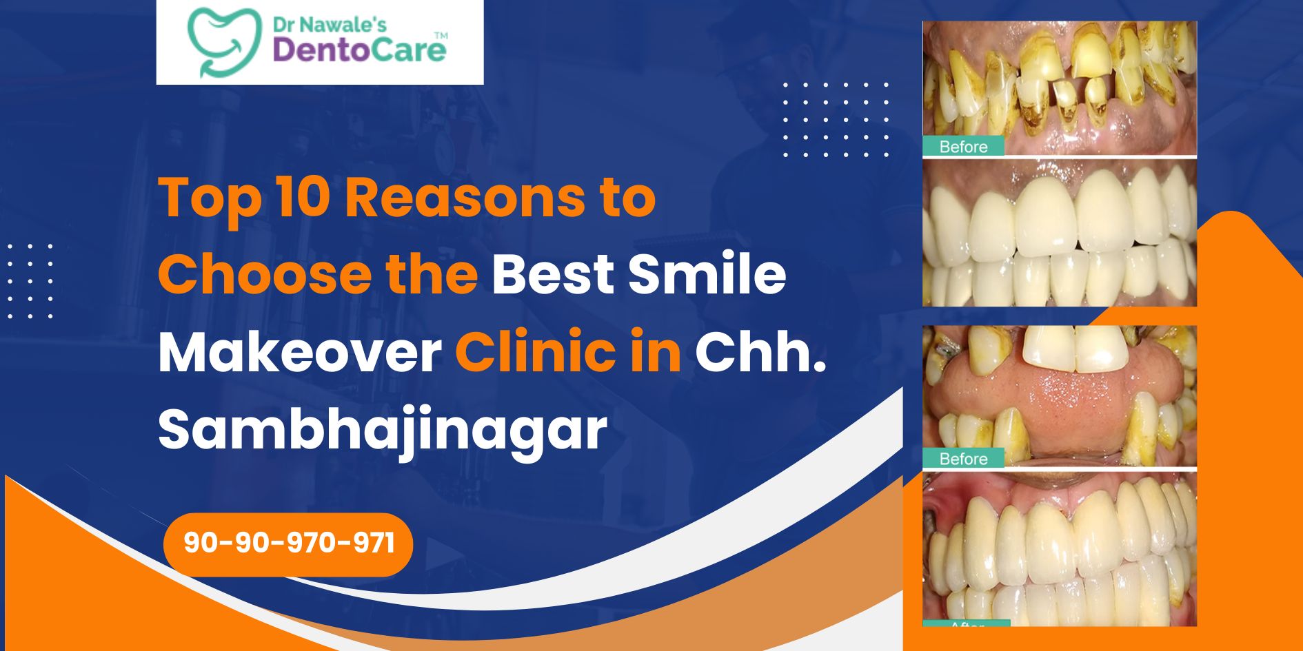 Top 10 Reasons to Choose the Best Smile Makeover Clinic in Chh. Sambhajinagar (Aurangabad)