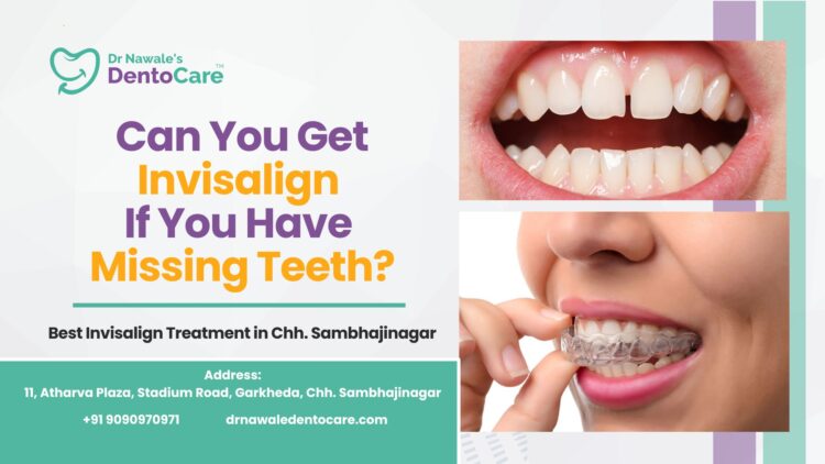 Can You Get Invisalign If You Have Missing Teeth Best Invisalign Treatment in Chh. Sambhajinagar (Aurangabad)