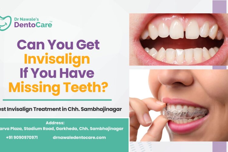 Can You Get Invisalign If You Have Missing Teeth Best Invisalign Treatment in Chh. Sambhajinagar (Aurangabad)