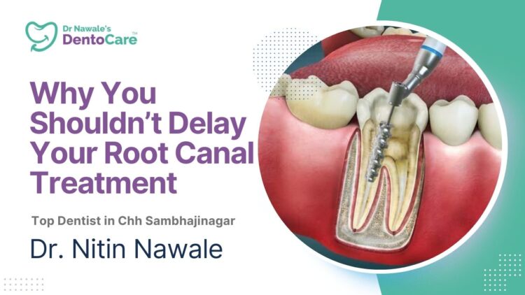Why You Shouldn’t Delay Your Root Canal Treatment Top dentist in chh sambhajinagar aurangabad