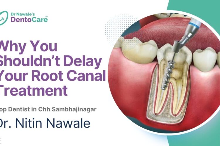Why You Shouldn’t Delay Your Root Canal Treatment Top dentist in chh sambhajinagar aurangabad