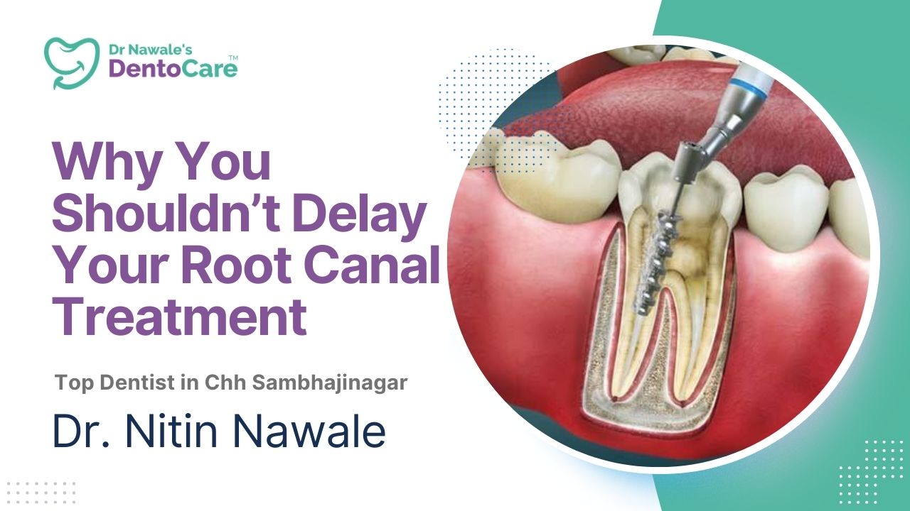 Why You Shouldn’t Delay Your Root Canal Treatment Top dentist in chh sambhajinagar aurangabad