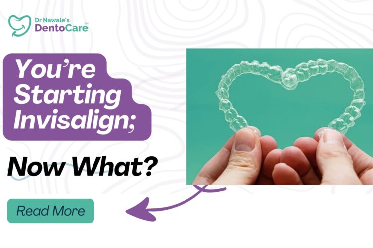 You’re Starting Invisalign; Now What A Complete Guide for Patients in Chh Sambhajinagar (Aurangabad)