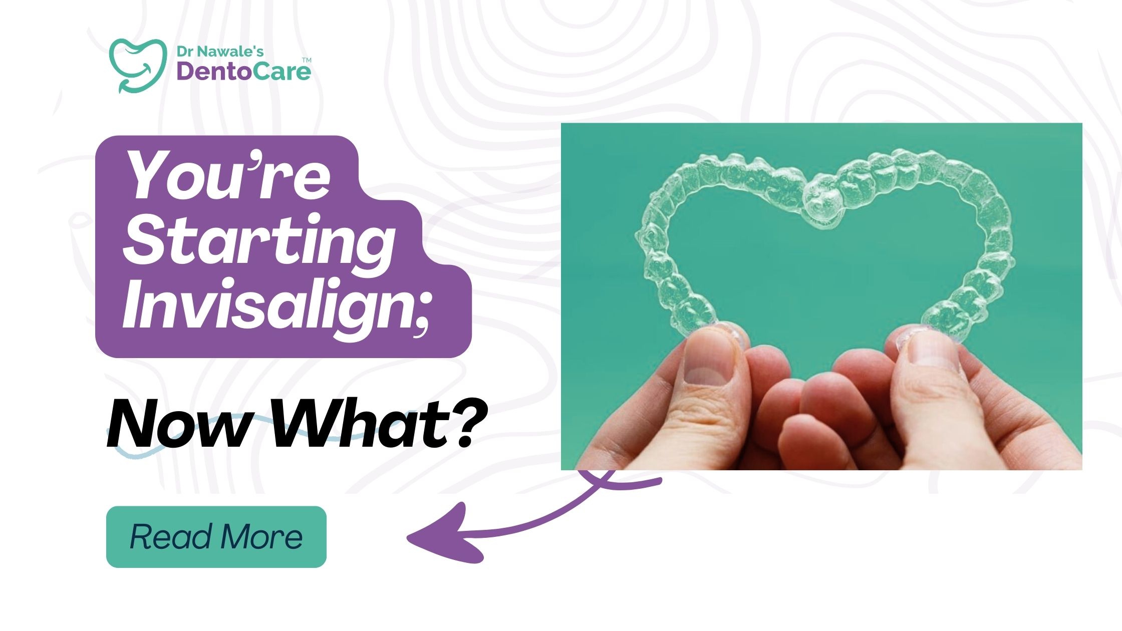 You’re Starting Invisalign; Now What A Complete Guide for Patients in Chh Sambhajinagar (Aurangabad)