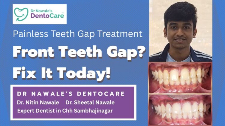front teeth gap filling treatment in chh sambhajinagar