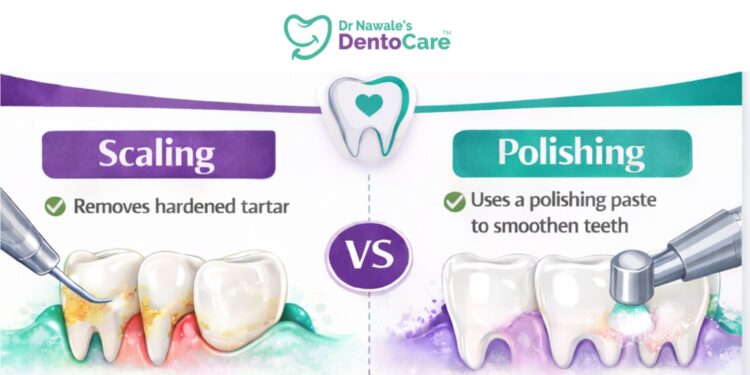 Difference Between Scaling & Polishing in dental cleaning procedures