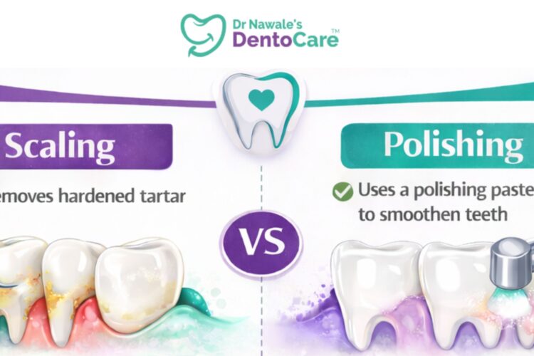 Difference Between Scaling & Polishing in dental cleaning procedures