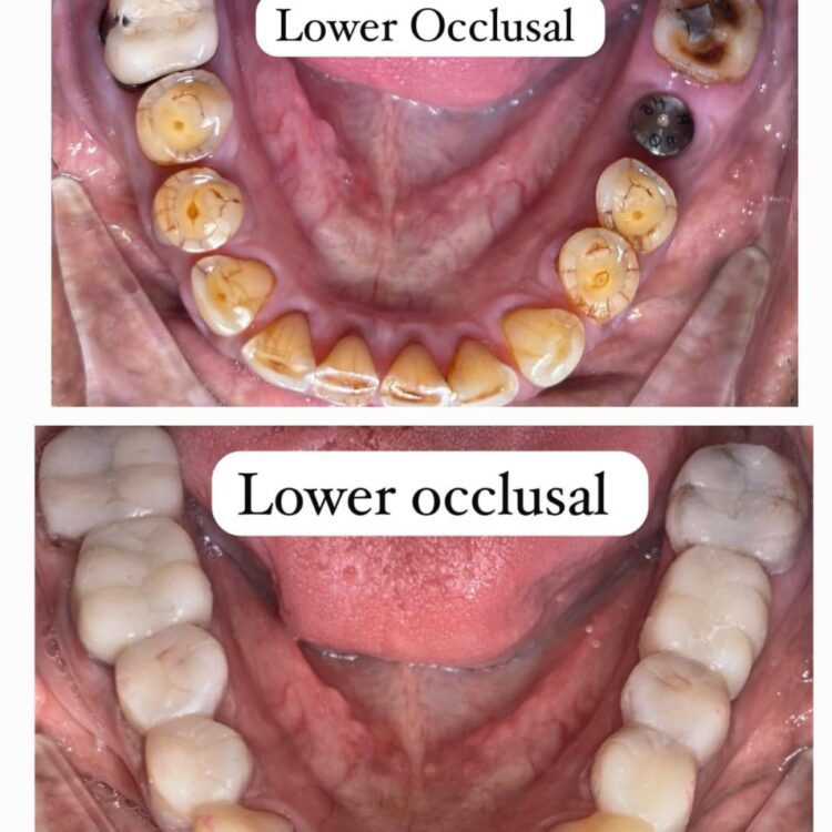 Best dental treatment by Dr. Nitin Nawale & Dr. Sheetal Nawale at Dr Nawale's DentoCare in Chh Sambhajinagar Aurangabad
