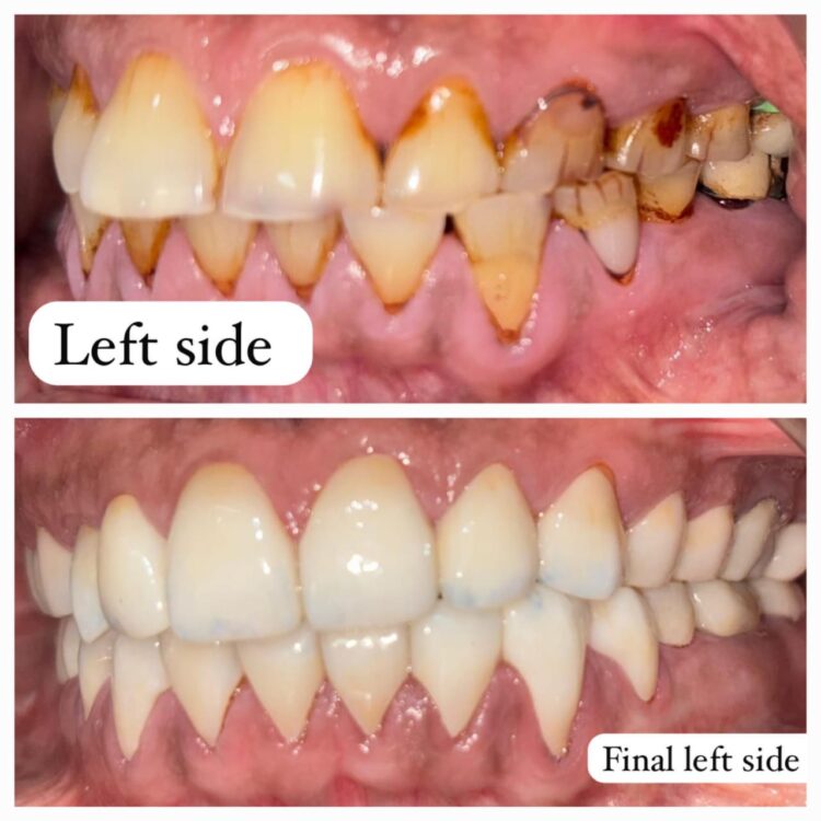 Best dental treatment by Dr. Nitin Nawale & Dr. Sheetal Nawale at Dr Nawale's DentoCare in Chh Sambhajinagar Aurangabad