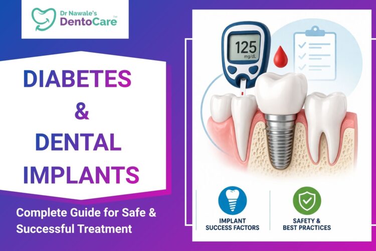 Diabetes and Dental Implants Complete Guide for Safe & Successful Treatment