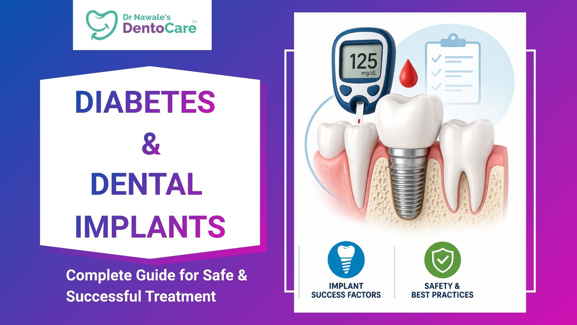 Diabetes and Dental Implants Complete Guide for Safe & Successful Treatment