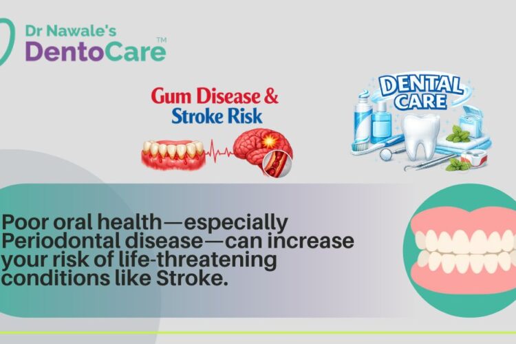 Gum Disease & Stroke Risk Advice from a Leading Dentist in Chh. Sambhajinagar