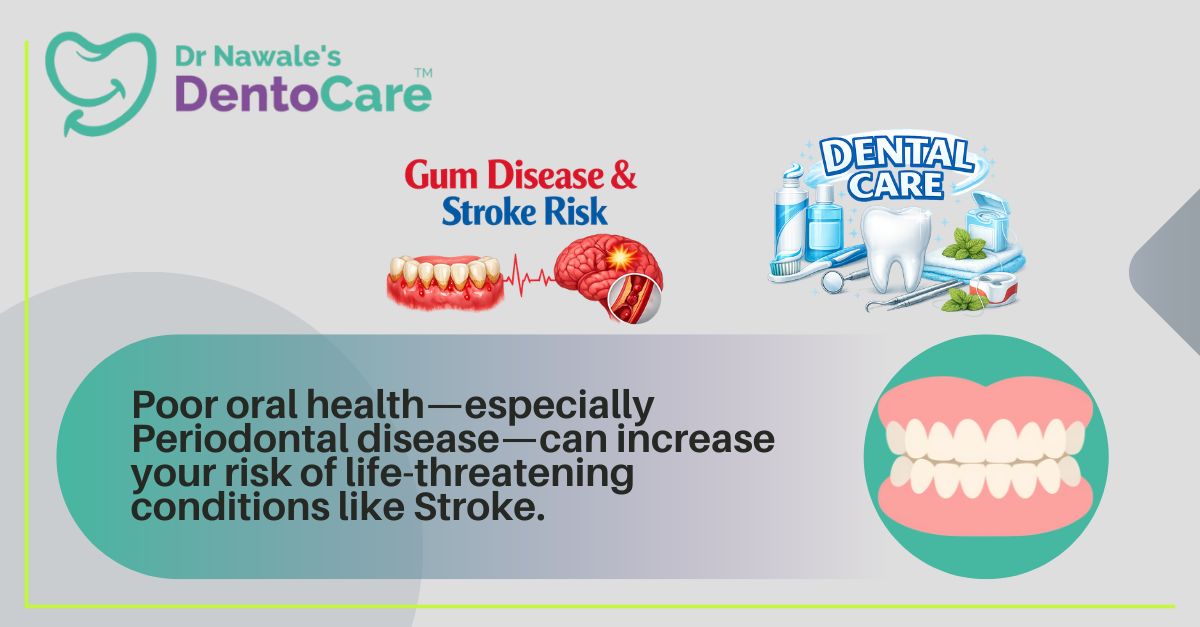 Gum Disease & Stroke Risk Advice from a Leading Dentist in Chh. Sambhajinagar