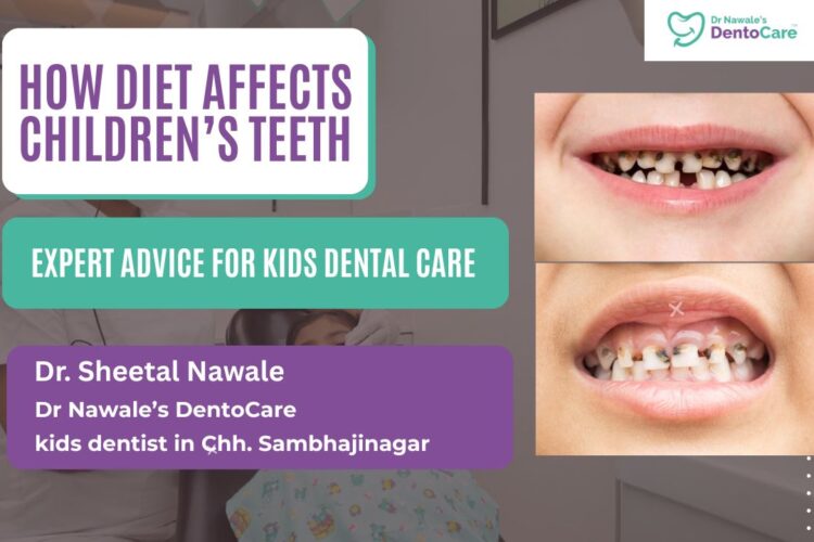 Kids at Risk Tooth Decay Strikes Early Due to Diet Changes & Poor Hygiene – Expert Advice from a Leading Kids Dentist in Chh. Sambhajinagar