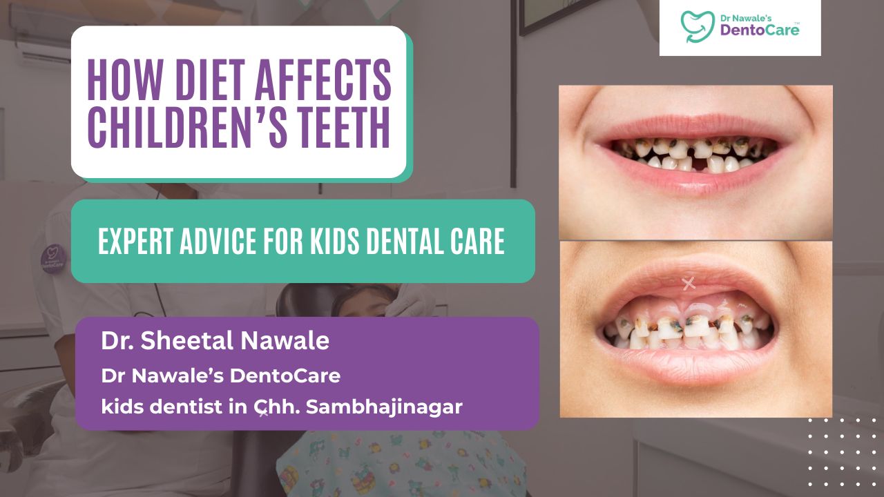 Kids at Risk Tooth Decay Strikes Early Due to Diet Changes & Poor Hygiene – Expert Advice from a Leading Kids Dentist in Chh. Sambhajinagar
