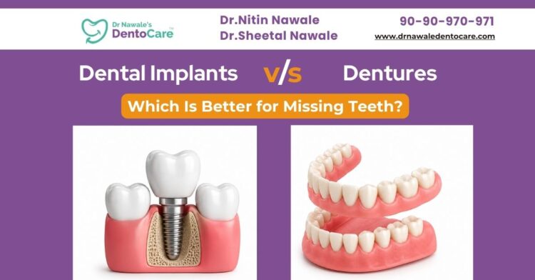 Dental Implants vs Dentures – Which Is Better for Missing Teeth