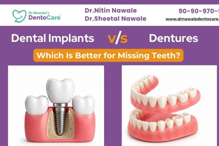 Dental Implants vs Dentures – Which Is Better for Missing Teeth
