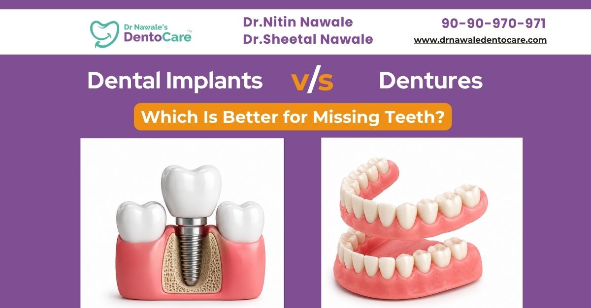 Dental Implants vs Dentures – Which Is Better for Missing Teeth