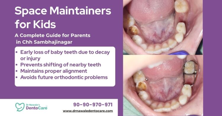 Dental Space Maintainers for Kids A Complete Guide for Parents in chh sambhajinagar