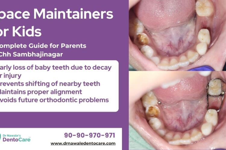 Dental Space Maintainers for Kids A Complete Guide for Parents in chh sambhajinagar