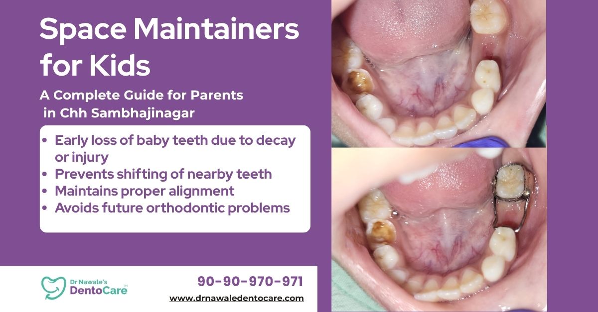 Dental Space Maintainers for Kids A Complete Guide for Parents in chh sambhajinagar