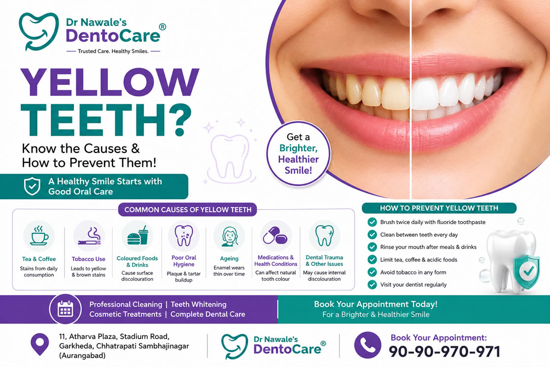 Common causes of yellow teeth and prevention tips by Dr Nawale's DentoCare in Chhatrapati Sambhajinagar