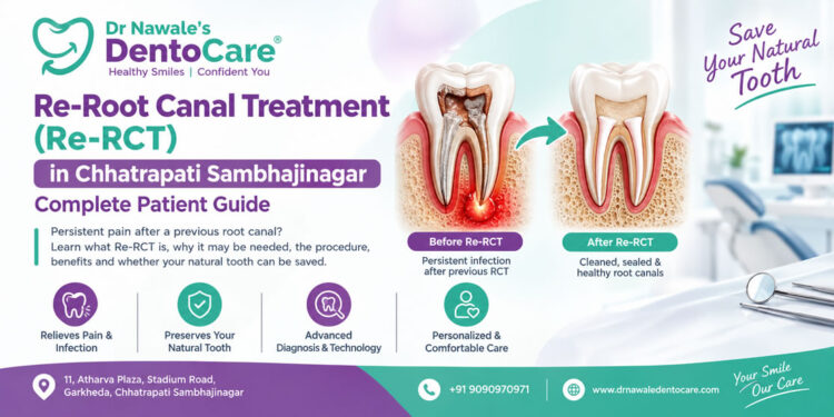 Re-Root Canal Treatment in Chhatrapati Sambhajinagar for failed root canal