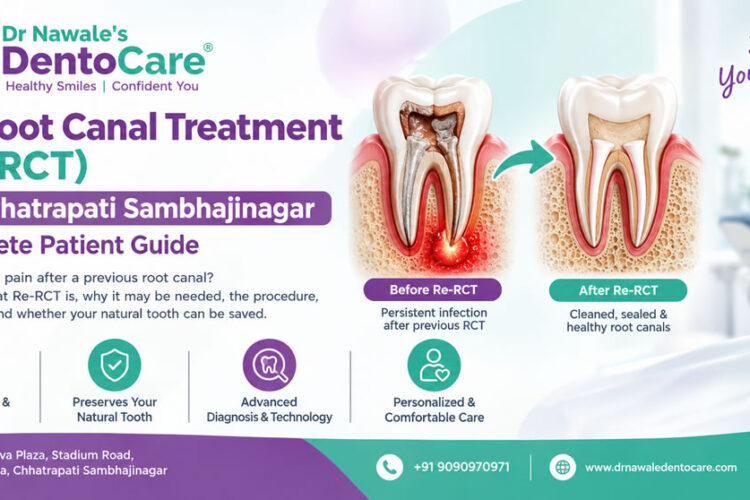 Re-Root Canal Treatment in Chhatrapati Sambhajinagar for failed root canal