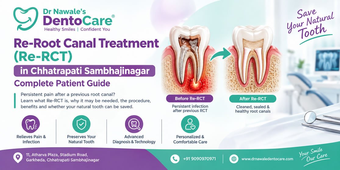 Re-Root Canal Treatment in Chhatrapati Sambhajinagar for failed root canal